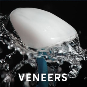 dental veneers